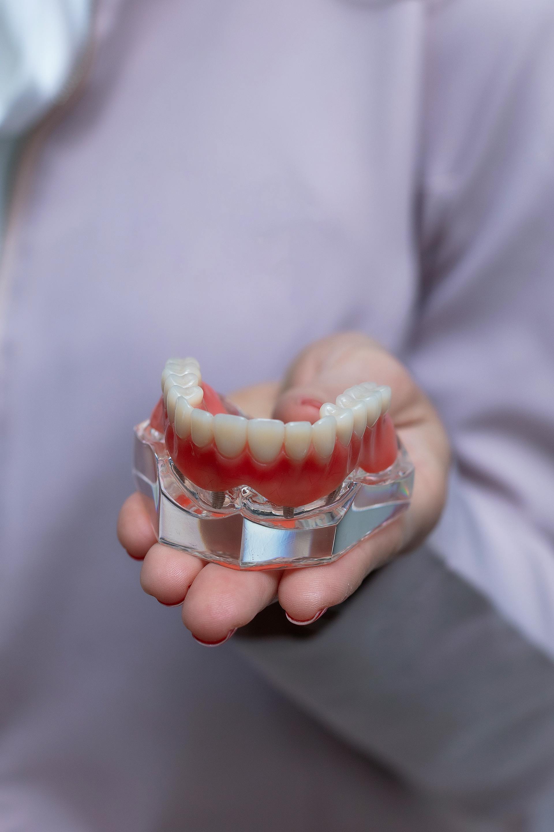 Usklađivanje boje zuba — estetska stomatologija